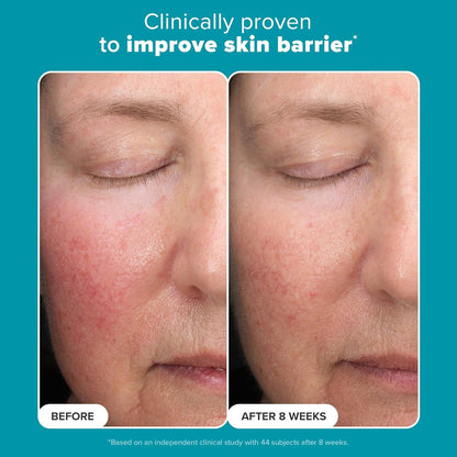 Paula’s Choice 6% Mandelic Acid + 2% Lactic Acid Exfoliant, Gentle Daily AHA Exfoliation for Discoloration, Bumpy Texture & Radiance, for Sensitive Skin, Fragrance-Free